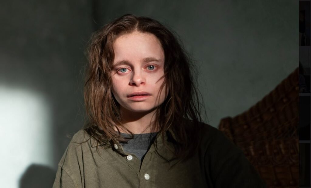imogen faith reid syndrome